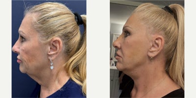 before and after image