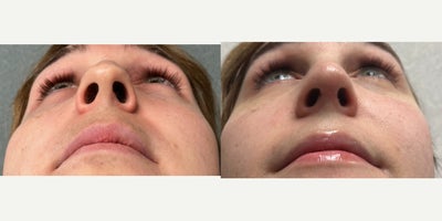before and after image