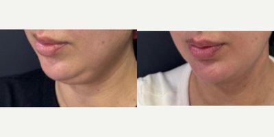 before and after image
