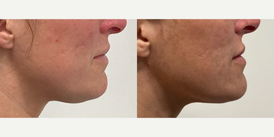 before and after image
