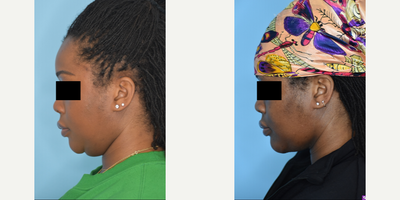 before and after image