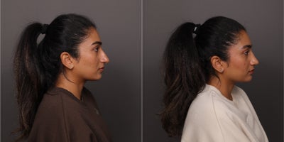 before and after image