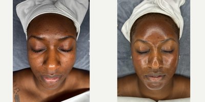 before and after image