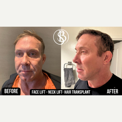 before and after image