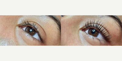 Woman treated with Yumi Lash Lift - Woman treated with Yumi Lash Lift