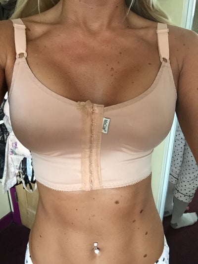 48 Years Old. Pre op breast size: 38L. Canada - Review - RealSelf