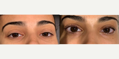Woman treated with  Yumi Lash Lift - Woman treated with Yumi Lash Lift