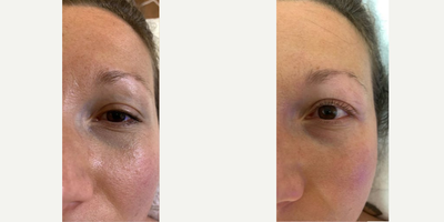 Woman treated with Yumi Lash Lift - Woman treated with Yumi Lash Lift