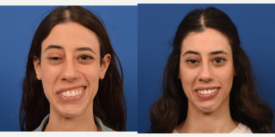 Facial Reconstructive Surgery - Facial Reconstructive Surgery