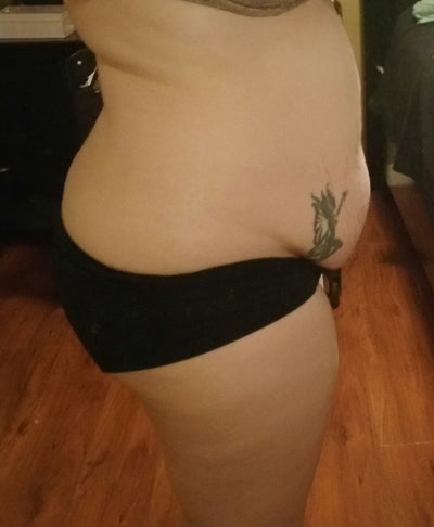 31 Yrs 190 Lbs 5 4 Female Mother Of 2 Sono Bello Laser