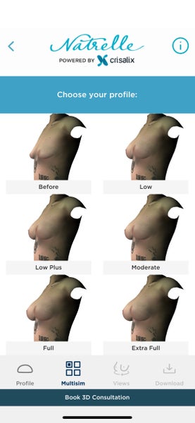 Breast Augmentation & Mastopexy on 31 Y/o [5'0 95lb] Female