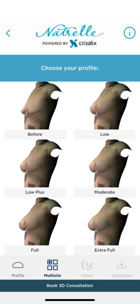 Breast implants for breast augmentation - Dr Boudana Plastic