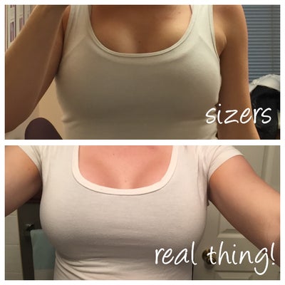 Breast Augmentation in Lethbridge, Alberta