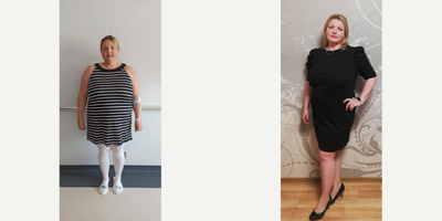 35-44 year old woman treated with Gastric Balloon - She cameto have Gastric Balloon in her stomach. We performed her surgery 4 months ago. She was 115 kg before her surgery. She lost 16 kg until now.