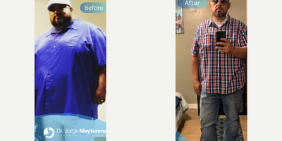 Woman treated with Gastric Sleeve Surgery - Are you ready to get started on your health journey?