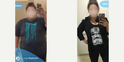 Woman treated with Gastric Sleeve Surgery - Helping to change the lives of my patients. Congratulations for your effort and commitment to reach your goal.