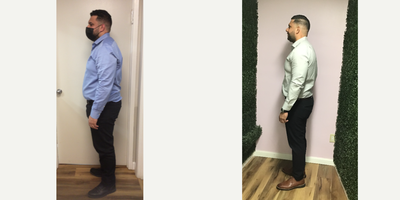 35-44 year old man treated with Endoscopic Sleeve Gastroplasty - Our patient lost a total of 36 Lbs in 18 months after his Endoscopic Sleeve Gastroplasty procedure. The patient reached his goal weight within the first six months and has maintained it ever since.