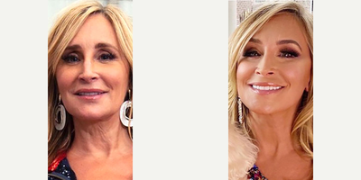 Deep Plane Facelift - As you can see from her facelift before and after, a facelift can look completely natural with my signature extended deep plane facelift technique with absolutely no tightness because I am lifting the deep musculature and fallen fat pads of the face not pulling on the skin! At the same time, I performed a necklift with platysmaplasty to treat laxity and neckbands.