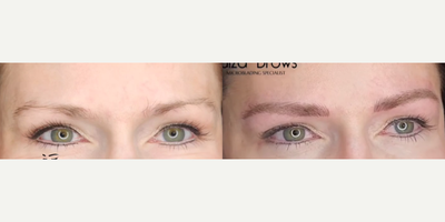 Woman treated with Microblading - Woman treated with Microblading