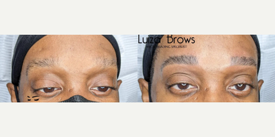 Woman treated with Microblading - Woman treated with Microblading