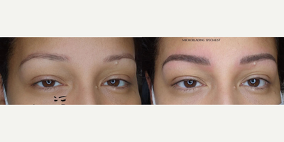 Woman treated with Microblading - Woman treated with Microblading