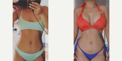 Woman treated with Breast Augmentation - Woman treated with Breast Augmentation using implants