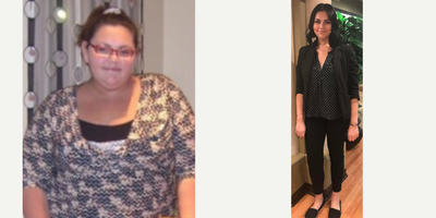 25-34 Year Old Young Woman Loses 194 Lbs. With The Lap Band Procedure - A happy 25-34 Year old young woman loses 194 lbs. with the lap band procedure and has kept off additional weight after 10 years.