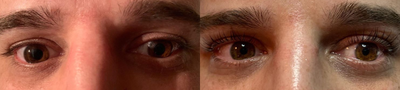 Man treated with Lash Lift - Man treated with Lash Lift