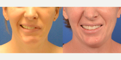 Facial Reconstructive Surgery - Facial Reconstructive Surgery
