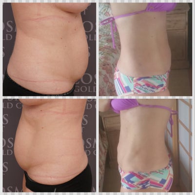 38 Year Old Mum with Fat Belly :)
