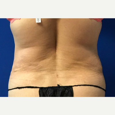 Timothy Mountcastle, MD Reviews, Before and After Photos, Answers - RealSelf