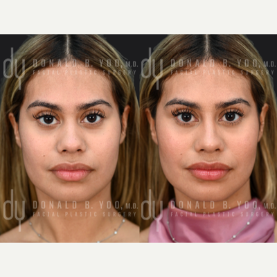 before and after image