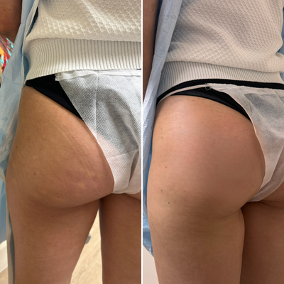 before and after image