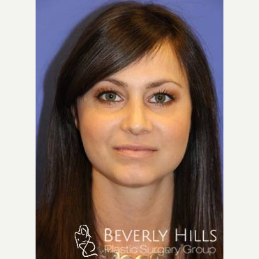 Body Contouring  Beverly Hills Plastic Surgery Group