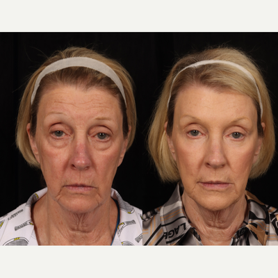 before and after image