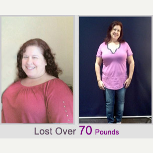 25-34 year old woman treated with Lap Band - Lost 70 pounds