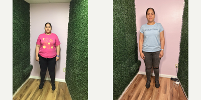 35-44 year old woman treated with Orbera Gastric Balloon, Gastric Balloon - She lost 60 LBS in 6 months after her Orbera Gastric Balloon weight loss procedure.
