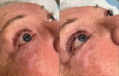 Lash Lift for WOW lashes! - Darker and curled lashes from a Lash Lift!