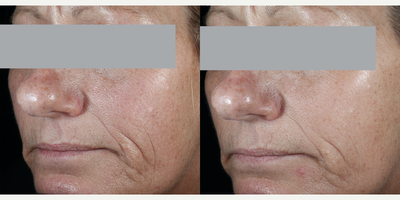SkinCeuticals, C E Ferulic - C E Ferulic. Photo provided courtesy of SkinCeuticals