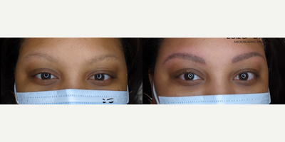 Woman treated with Microblading - Woman treated with Microblading