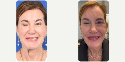Facial Reconstructive Surgery - Facial Reconstructive Surgery