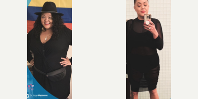 Woman treated with Gastric Sleeve Surgery - Congratulations on your incredible success!We always knew you could do it, and We are incredibly proud of you
