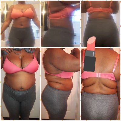 25, 5'6 145 Lb.. 36DDD - Dallas, TX - Review - RealSelf