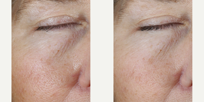 Skinbetter Science - Instant Effect Gel Eye.Photo provided courtesy of Skinbetter Science.
