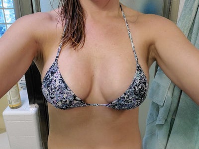 20 YO, 145 Lb, 5'3 with 34H Breasts Applying with BCBS - Review 