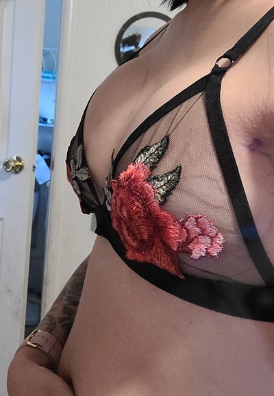 28FF/30F 5'3, 115 Lbs, sore, saggy Breasts - Review - RealSelf