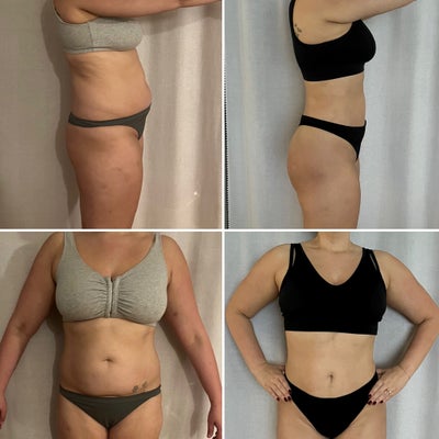 30 day discount hip dip transformation