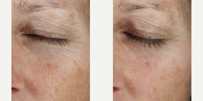 Skinbetter Science - Instant Effect Gel Eye.Photo provided courtesy of Skinbetter Science.