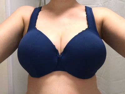 My journey to breast reduction— 30JJ 29 years old, 5'7, 150 lbs