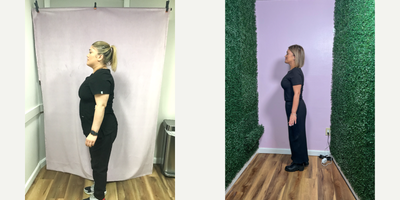 25-34 year old woman treated with Endoscopic Sleeve Gastroplasty - She lost 55 lbs with the Endoscopic Sleeve Gastroplasty procedure after 9 months